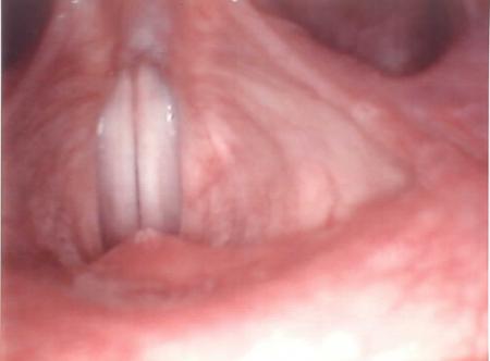 Matos des chanteuses